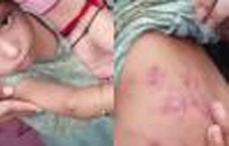 سیلاب متاثرین کھلے آسمان تلے رہنے پر مجبور، بچوں اور بڑوں میں جلدی امراض سمیت مختلف بیماریاں پھیلنے لگیں
